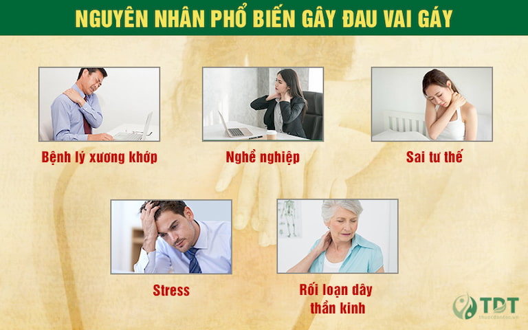 Một số nguyên nhân phổ biến gây đau vai gáy