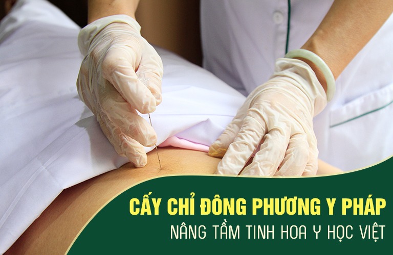 Trung tâm Đông phương Y pháp chữa xương khớp nhờ liệu pháp cấy chỉ