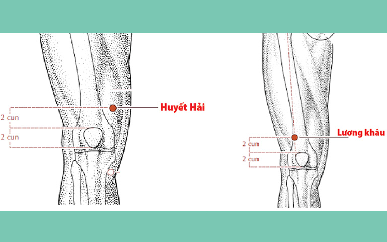 Ví trí huyệt Huyết hải và huyệt Lương Khâu chữa đau đầu gối