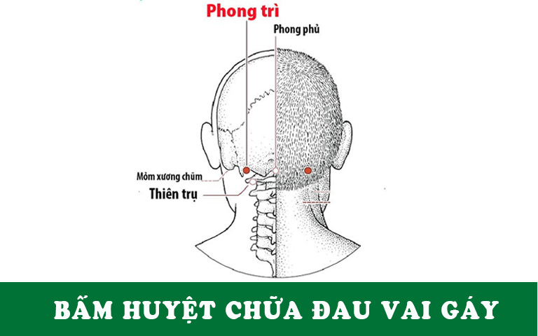 Các vị trí huyệt trị đau vai gáy