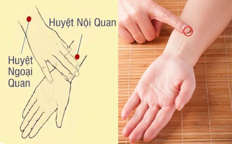 Huyệt nội quan nằm ở mặt trong cổ tay