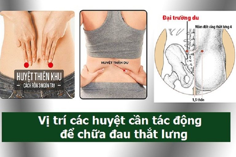 Các vị trí bấm huyệt chữa đau lưng