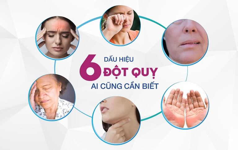 Đột quỵ có nhiều dấu hiệu nhận biết