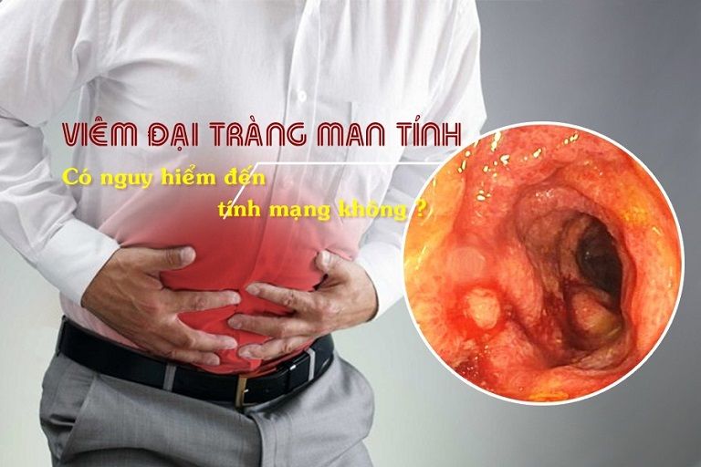 Bệnh có thể gây ra nhiều biến chứng thậm chí nguy hiểm tính mạng