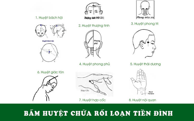 Các vị trí bấm huyệt chữa rối loạn tiền đình