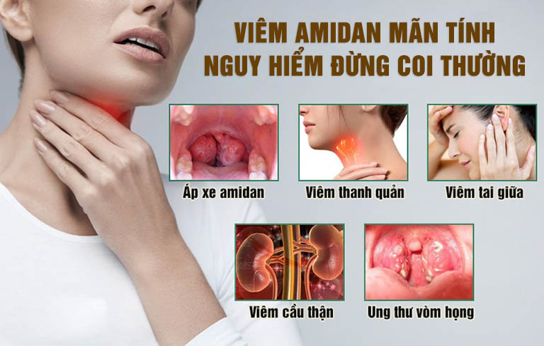 Bệnh có khả năng gây ra nhiều biến chứng nguy hiểm