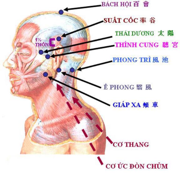 Các huyệt cần châm cứu chữa tai biến 