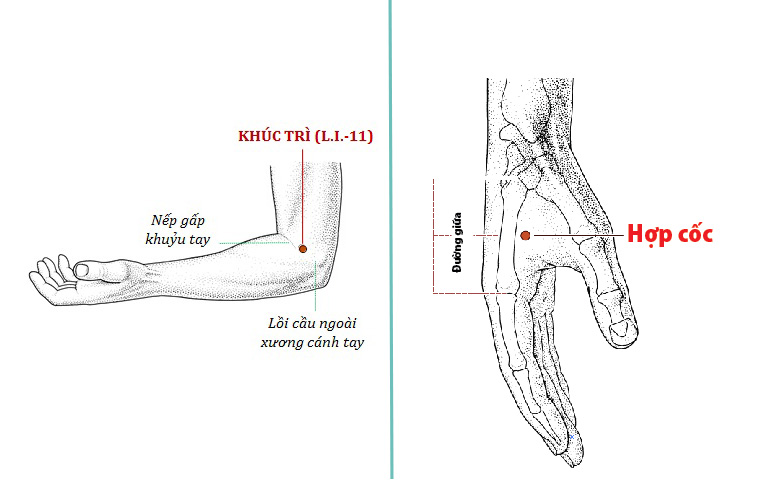 Các huyệt tay trị tai biến