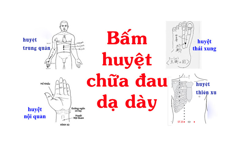 Các huyệt bổ trợ trị đau dạ dày