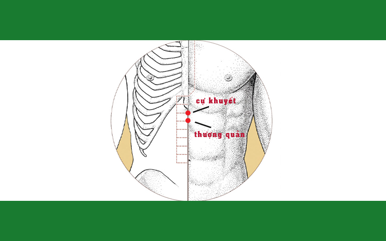 Huyệt Cự khuyết và Thượng quản