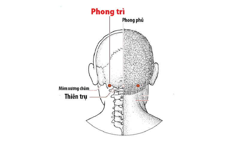 Vị trí huyệt Phong Trì