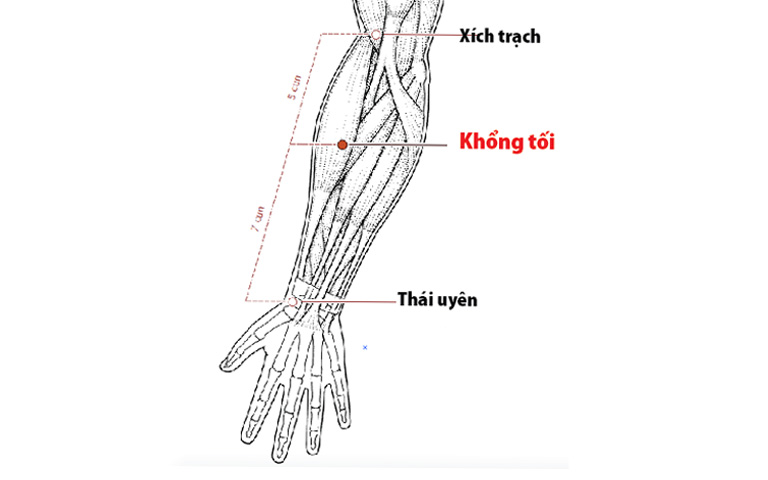 Huyệt Xích Trạch và Khổng Tối chữa viêm amidan