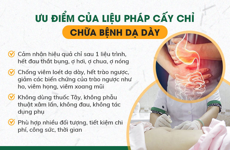 Phương pháp cấy chỉ chữa dạ dày có nhiều ưu điểm vượt trội