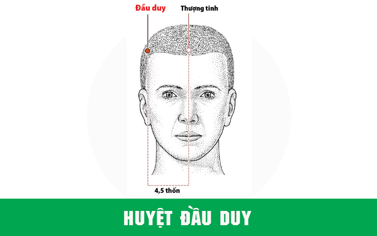 Huyệt Đầu Duy nằm ở hai bên góc trán, cách huyệt Thượng Tinh 4,5 thốn