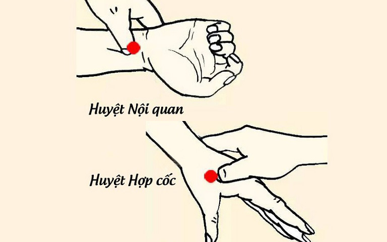 Day Nội Quan và Hợp Cốc để phòng chống say xe