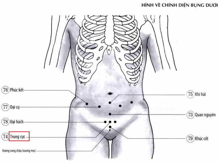 Xác định vị trí huyệt trung cực