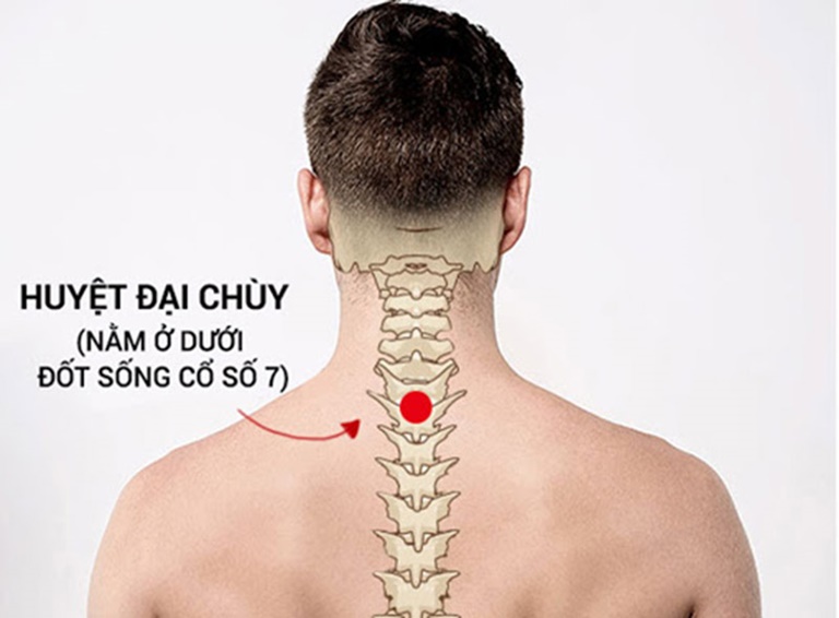 Bấm huyệt đại chùy giúp làm giảm triệu chứng viêm họng