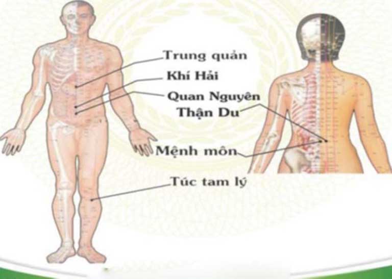 Phối huyệt Trung Quản trị được nhiều bệnh lý nguy hiểm