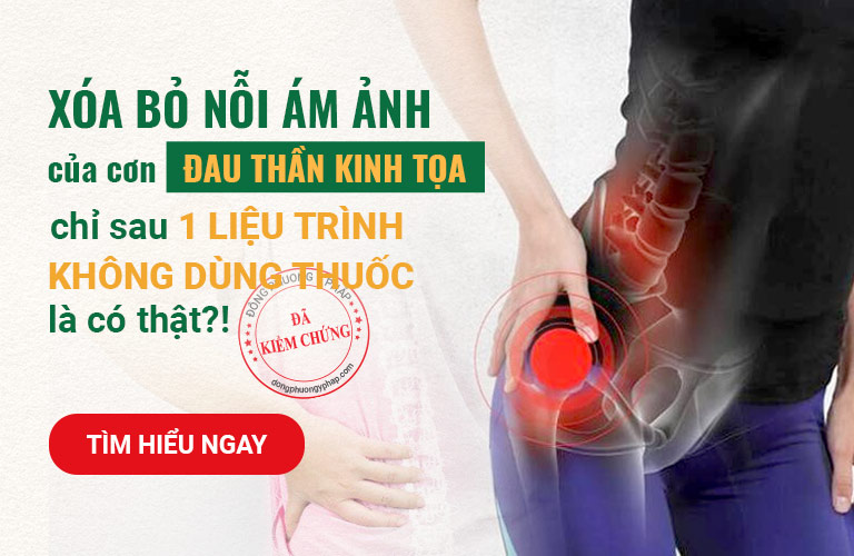 XÓA BỎ Nỗi Ám Ảnh Của Cơn Đau Thần Kinh Tọa CHỈ 1 LIỆU TRÌNH