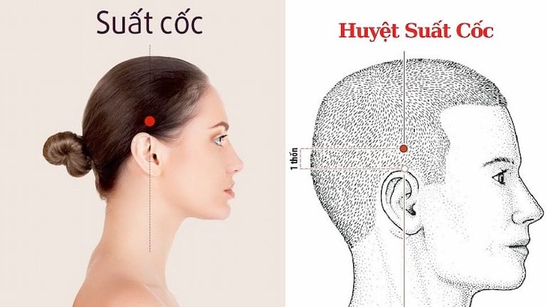 Hình ảnh huyệt Suất Cốc ở vùng đầu