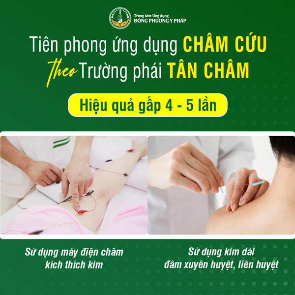 Ưu điểm vượt trội khi châm cứu theo Trường phái Tân Châm