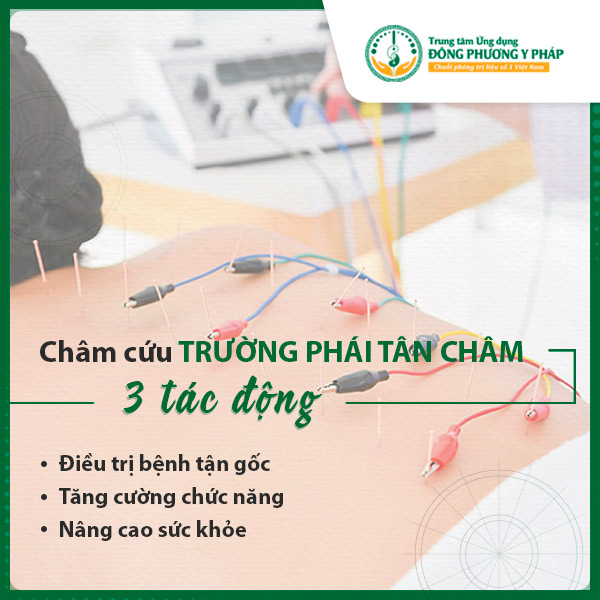 Đông Phương Y Pháp ứng dụng châm cứu theo Trường phái Tân Châm mang lại 3 tác động cho sức khỏe