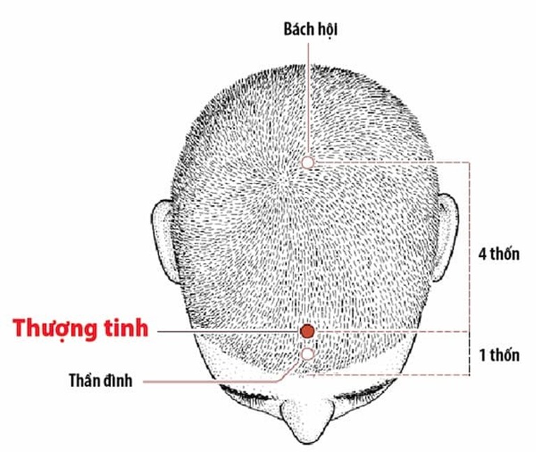 Huyệt Thần đình là một trong số 108 đại huyệt trên cơ thể