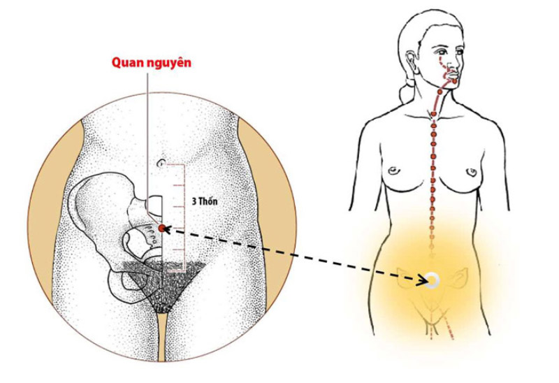 Huyệt Quan Nguyên có tác dụng khi đã đến giai đoạn sa búi trĩ nặng