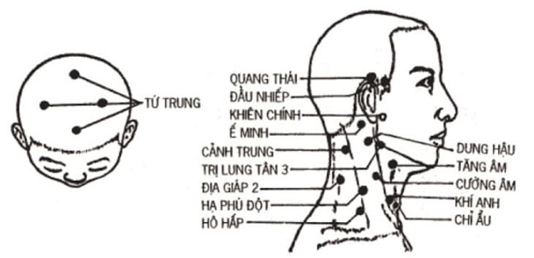 Huyệt Ế Minh là một tiểu huyệt nằm ở phần đầu.