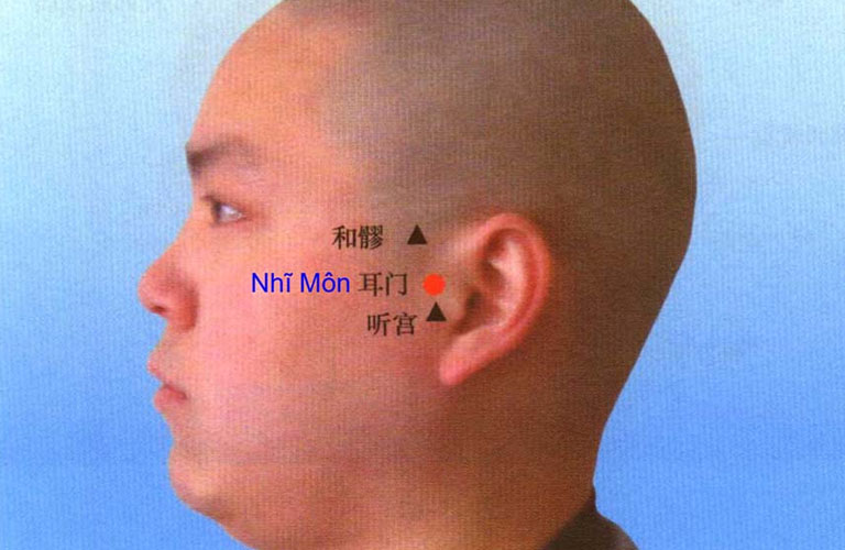 Tổng quan huyệt Nhĩ Môn