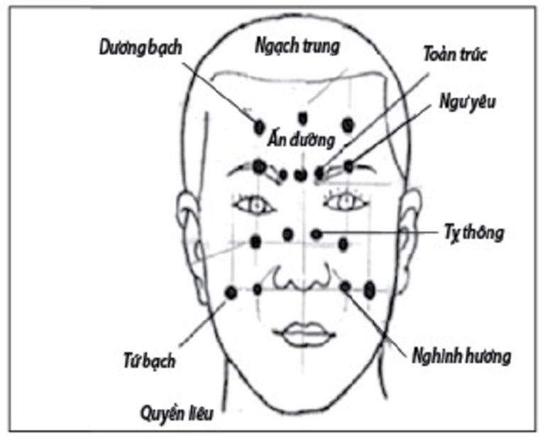 Vị trí huyệt Tỵ Thông trên gương mặt