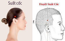 Huyệt Suất Cốc: Vị Trí, Tác Dụng Và Cách Châm Cứu Bấm Huyệt