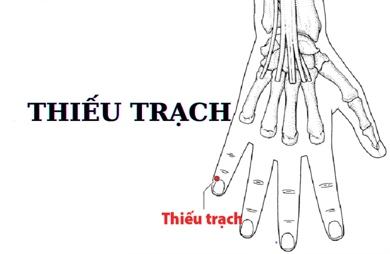 Huyệt Thiếu Trạch ằm ở mặt ngoài của ngón tay út