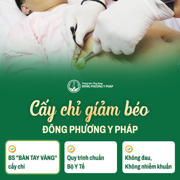 Cấy chỉ giảm béo Đông Phương Y Pháp