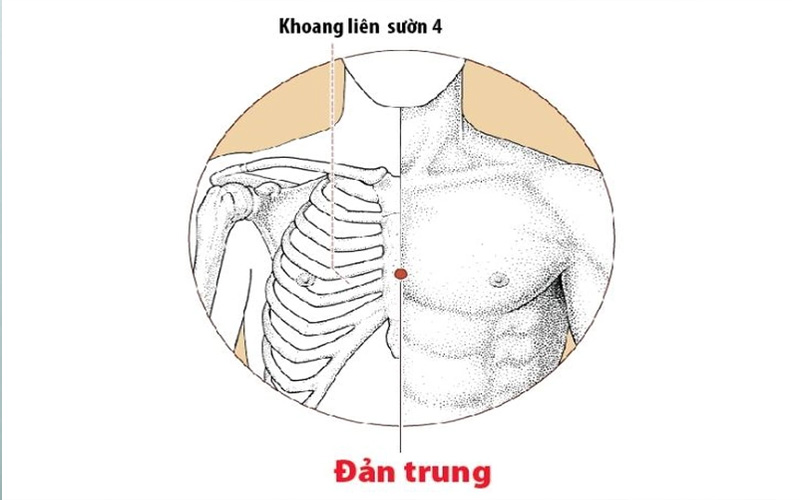 Châm cứu đúng vị trí huyệt vị này để cải thiện bệnh