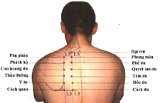 Huyệt Đốc Du: Vị trí, Cách Xác Định Và Tác Dụng Chữa Bệnh