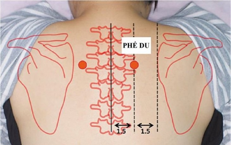 Kết hợp huyệt Phế Du với các huyệt đạo khác giúp cải thiện sức khỏe