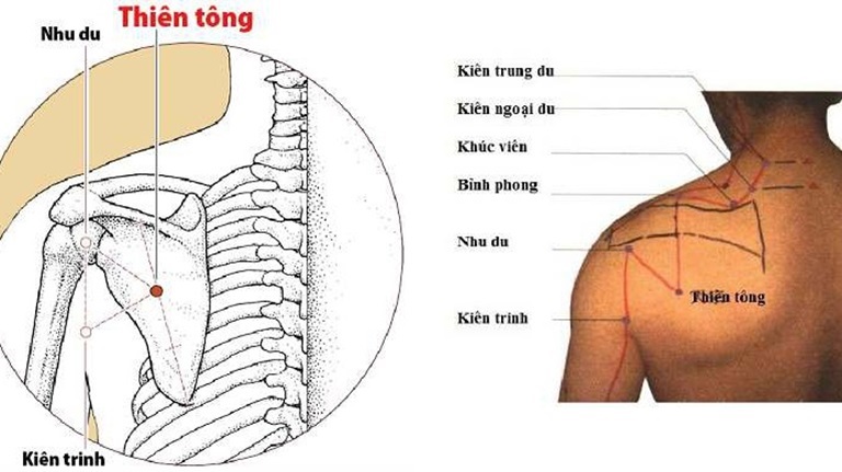 Vị trí của huyệt Thiên Tông trên cơ thể