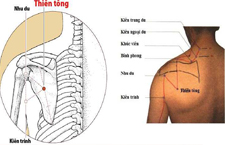 Huyệt Thiên Tông: Vị Trí, Cách Xác Định Và Tác Dụng Trị Đau Vai Gáy