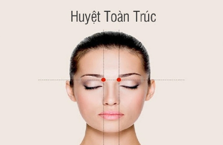 Vị trí huyệt Toản Trúc