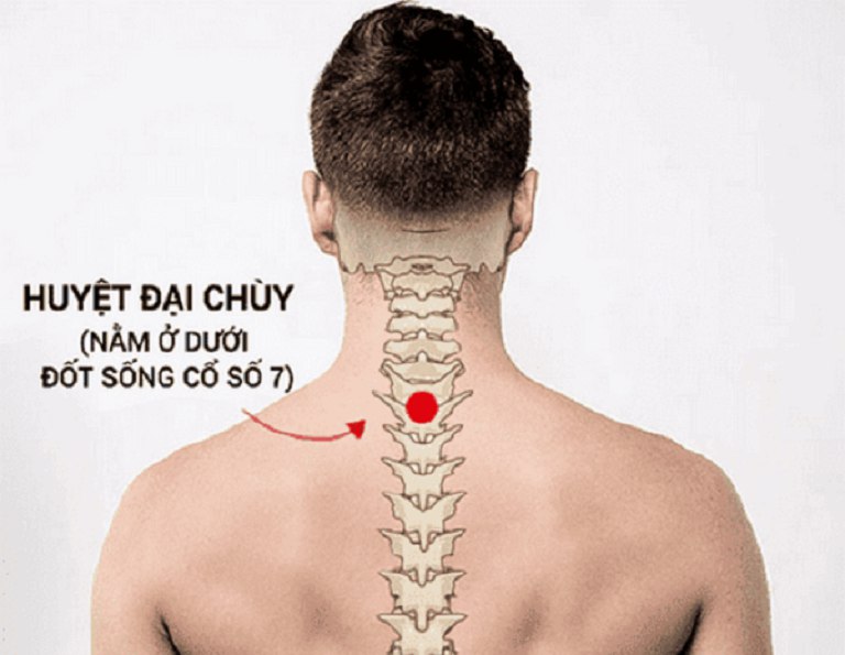 Vị trí huyệt Đại chùy trên cơ thể