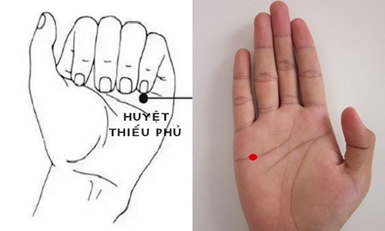 Huyệt Thiếu Phủ là huyệt đạo quan trọng của Y học cổ truyền