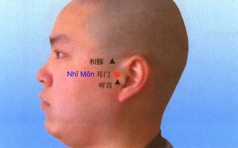 Vị trí huyệt Nhĩ Môn