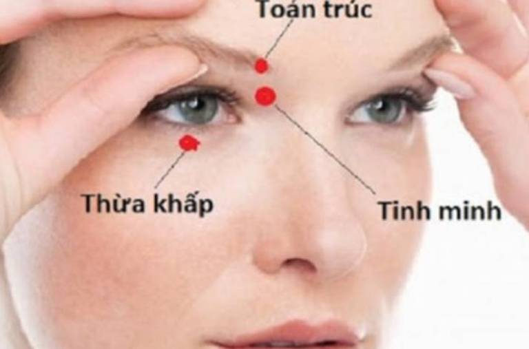 Bấm huyệt Tinh Minh giảm triệu chứng đau mỏi mắt