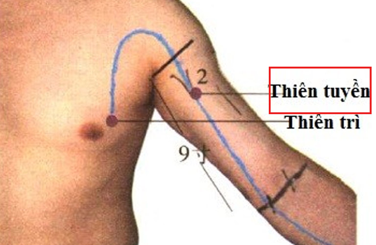 Huyệt Thiên Tuyền có vị trí nằm ở dưới đầu nếp nách trước