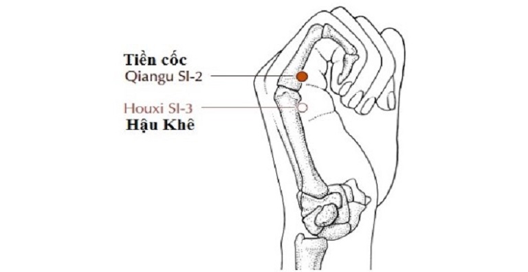 Huyệt Tiền Cốc nằm ở xương cuối ngón tay út