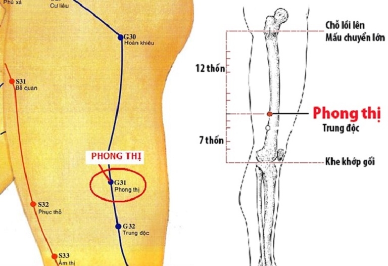 Vị trí huyệt Trung Độc nằm ở phần đùi bên ngoài