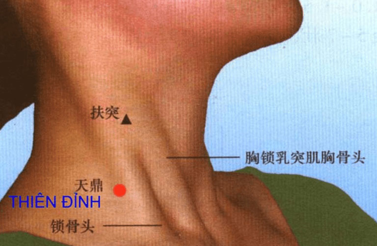 Huyệt Thiên Đỉnh: Vị Trí, Chức Năng và Ứng Dụng Trong Điều Trị