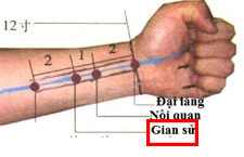 Huyệt Giản Sử Là Gì? Xác Định Vị Trí, Ứng Dụng Điều Trị Bệnh