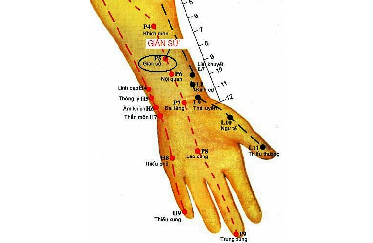 Phối huyệt Giản Sử với các huyệt đạo tương hợp giúp nâng cao hiệu quả trị bệnh